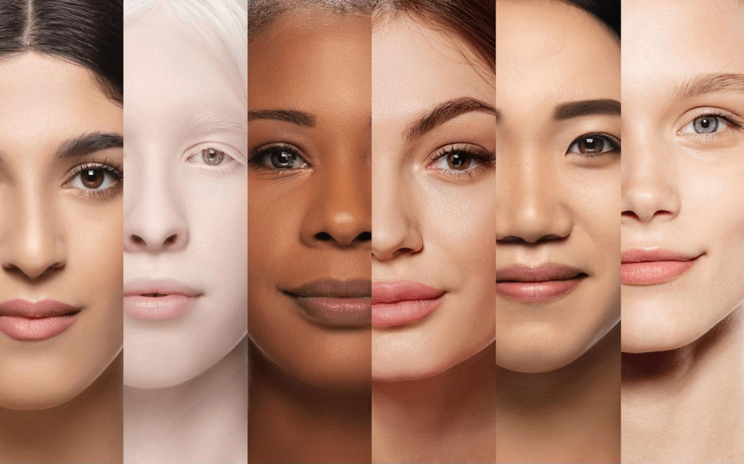 different skintype